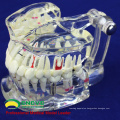 SELL 12567 Life Size Transparent Dental with Implant Tooth